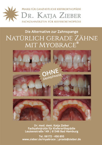 Informations-Flyer "Die Alternative zur Zahnspange" - Myobrace