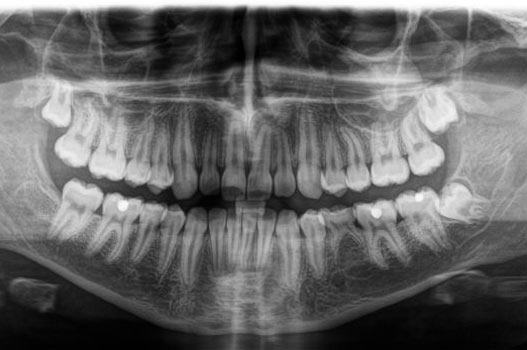 Kieferorthopädie Röntgenbild 1